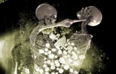 12769843-two-skeletons-who-are-fighting-as-they-decay